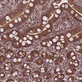 Anti-CLINT1 antibody produced in rabbit Prestige Antibodies® Powered by Atlas Antibodies, affinity isolated antibody, buffered aqueous glycerol solution
