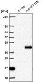Anti-TNFRSF13B antibody produced in rabbit Prestige Antibodies® Powered by Atlas Antibodies, affinity isolated antibody, buffered aqueous glycerol solution