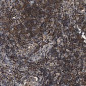 Anti-CCM2 antibody produced in rabbit Prestige Antibodies® Powered by Atlas Antibodies, affinity isolated antibody, buffered aqueous glycerol solution, Ab1