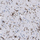 Anti-P2RY12 antibody produced in rabbit Prestige Antibodies® Powered by Atlas Antibodies, affinity isolated antibody, buffered aqueous glycerol solution