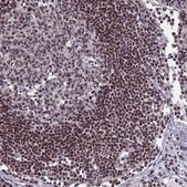 Anti-NSL1 antibody produced in rabbit Prestige Antibodies® Powered by Atlas Antibodies, affinity isolated antibody, buffered aqueous glycerol solution