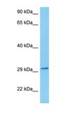 Anti-IGFBP2 antibody produced in rabbit affinity isolated antibody