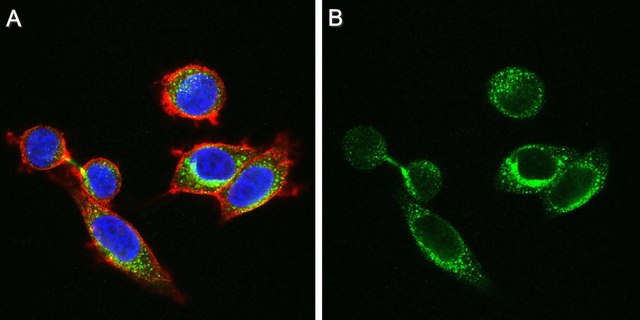 Anti-ADAMTS-1 Antibody purified antibody, clone 5D4E11B6, from mouse
