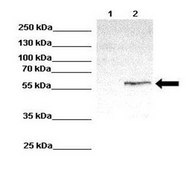 Anti-ETV1 antibody produced in rabbit affinity isolated antibody