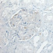 Monoclonal Anti-PLA2R1 antibody produced in mouse Prestige Antibodies® Powered by Atlas Antibodies, clone CL0485, purified immunoglobulin, buffered aqueous glycerol solution