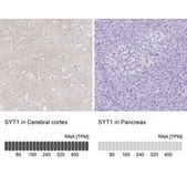 Anti-SYT1 antibody produced in rabbit Prestige Antibodies® Powered by Atlas Antibodies, affinity isolated antibody, buffered aqueous glycerol solution