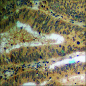 Anti-phospho-PPAR-γ (pSer112) antibody produced in rabbit affinity isolated antibody