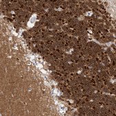 Anti-CAMK2B antibody produced in rabbit Prestige Antibodies® Powered by Atlas Antibodies, affinity isolated antibody, buffered aqueous glycerol solution