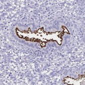 Anti-SLC34A2 antibody produced in rabbit Prestige Antibodies® Powered by Atlas Antibodies, affinity isolated antibody, buffered aqueous glycerol solution