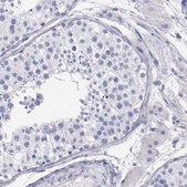Anti-PRX antibody produced in rabbit Prestige Antibodies® Powered by Atlas Antibodies, affinity isolated antibody, buffered aqueous glycerol solution
