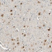 Anti-MCPH1 antibody produced in rabbit Prestige Antibodies® Powered by Atlas Antibodies, affinity isolated antibody, buffered aqueous glycerol solution