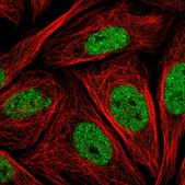 Anti-LMO4 antibody produced in rabbit Prestige Antibodies® Powered by Atlas Antibodies, affinity isolated antibody, buffered aqueous glycerol solution