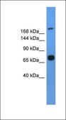 Anti-MYH7 antibody produced in rabbit affinity isolated antibody