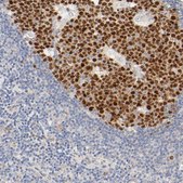 Anti-MEF2B antibody produced in rabbit Prestige Antibodies® Powered by Atlas Antibodies, affinity isolated antibody, buffered aqueous glycerol solution
