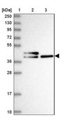 Anti-CHID1 antibody produced in rabbit Prestige Antibodies® Powered by Atlas Antibodies, affinity isolated antibody, buffered aqueous glycerol solution