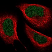 Anti-ZC3H8 antibody produced in rabbit Prestige Antibodies® Powered by Atlas Antibodies, affinity isolated antibody, buffered aqueous glycerol solution