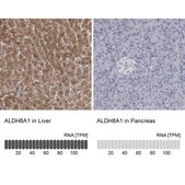 Anti-ALDH8A1 antibody produced in rabbit Prestige Antibodies® Powered by Atlas Antibodies, affinity isolated antibody, buffered aqueous glycerol solution