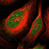 Anti-CAMK4 antibody produced in rabbit Prestige Antibodies® Powered by Atlas Antibodies, affinity isolated antibody, buffered aqueous glycerol solution