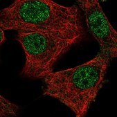 Anti-MED11 antibody produced in rabbit Prestige Antibodies® Powered by Atlas Antibodies, affinity isolated antibody, buffered aqueous glycerol solution