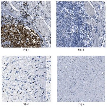 Anti-Pax5 Antibody, clone 1H9 clone 1H9, from rat