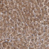 Anti-ALDH8A1 antibody produced in rabbit Prestige Antibodies® Powered by Atlas Antibodies, affinity isolated antibody, buffered aqueous glycerol solution