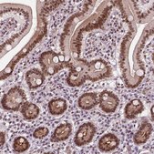 Anti-NACC1 antibody produced in rabbit Prestige Antibodies® Powered by Atlas Antibodies, affinity isolated antibody, buffered aqueous glycerol solution