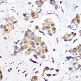 Anti-KDM1 / LSD1 Antibody, clone 7R10X6, Rabbit Monoclonal