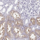 Anti-SLC22A6 Prestige Antibodies® Powered by Atlas Antibodies, affinity isolated antibody