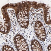 Anti-LGALS3 antibody produced in rabbit Prestige Antibodies® Powered by Atlas Antibodies, affinity isolated antibody, buffered aqueous glycerol solution