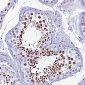 Anti-KCNK17 antibody produced in rabbit Prestige Antibodies® Powered by Atlas Antibodies, affinity isolated antibody, buffered aqueous glycerol solution