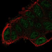 Anti-SMYD3 antibody produced in rabbit Prestige Antibodies® Powered by Atlas Antibodies, affinity isolated antibody
