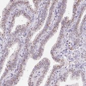 Anti-SP9 antibody produced in rabbit Prestige Antibodies® Powered by Atlas Antibodies, affinity isolated antibody, buffered aqueous glycerol solution