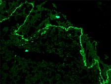 Monoclonal Anti-Collagen, Type VII antibody produced in mouse clone LH7.2, ascites fluid