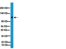 Anticuerpo anti-integrina β1, clon MB1.2 clone MB1.2, Chemicon®, from rat