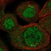Anti-RASSF6 antibody produced in rabbit Prestige Antibodies® Powered by Atlas Antibodies, affinity isolated antibody