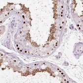 Anti-DPPA4 antibody produced in rabbit Prestige Antibodies® Powered by Atlas Antibodies, affinity isolated antibody, buffered aqueous glycerol solution