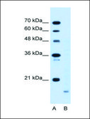 Anti-PPIB (AB1) antibody produced in rabbit IgG fraction of antiserum