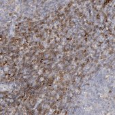 Anti-C1QC antibody produced in rabbit Prestige Antibodies® Powered by Atlas Antibodies, affinity isolated antibody, buffered aqueous glycerol solution