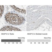 Anti-AKAP12 antibody produced in rabbit Prestige Antibodies® Powered by Atlas Antibodies, affinity isolated antibody, buffered aqueous glycerol solution