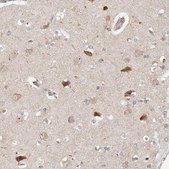 Anti-ZRANB1 antibody produced in rabbit Prestige Antibodies® Powered by Atlas Antibodies, affinity isolated antibody, buffered aqueous glycerol solution, ab3