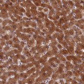 Anti-SULT2A1 antibody produced in rabbit Prestige Antibodies® Powered by Atlas Antibodies, affinity isolated antibody, buffered aqueous glycerol solution