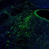 Anti-RCN2 antibody produced in rabbit Prestige Antibodies® Powered by Atlas Antibodies, affinity isolated antibody, buffered aqueous glycerol solution