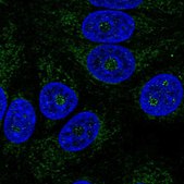 Anti-ABHD11 antibody produced in rabbit Prestige Antibodies® Powered by Atlas Antibodies, affinity isolated antibody, buffered aqueous glycerol solution