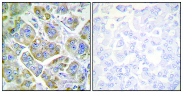Anti-Integrin β4 antibody produced in rabbit affinity isolated antibody