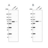 Anti-STAM2 antibody produced in rabbit Prestige Antibodies® Powered by Atlas Antibodies, affinity isolated antibody, buffered aqueous glycerol solution