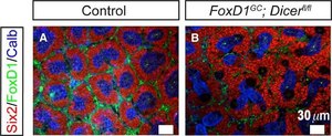 Monoclonal Anti-Calbindin-D-28K antibody produced in mouse clone CB-955, ascites fluid