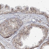 Anti-HGSNAT antibody produced in rabbit Prestige Antibodies® Powered by Atlas Antibodies, affinity isolated antibody, buffered aqueous glycerol solution
