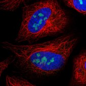 Anti-UTP3 antibody produced in rabbit Prestige Antibodies® Powered by Atlas Antibodies, affinity isolated antibody, buffered aqueous glycerol solution