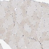 Anti-EHBP1 antibody produced in rabbit Prestige Antibodies® Powered by Atlas Antibodies, affinity isolated antibody, buffered aqueous glycerol solution