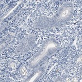 Anti-SAGE1 antibody produced in rabbit Ab2, Prestige Antibodies® Powered by Atlas Antibodies, affinity isolated antibody, buffered aqueous glycerol solution